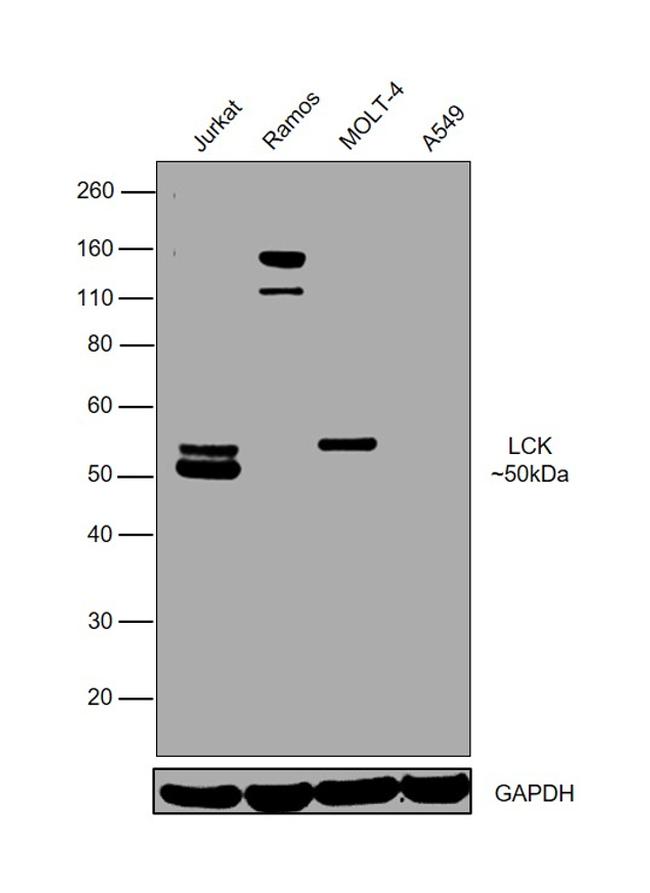 LCK Antibody in Western Blot (WB)