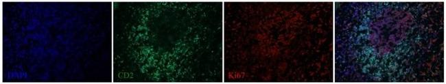 Ki-67 Antibody in Immunohistochemistry (Frozen) (IHC (F))