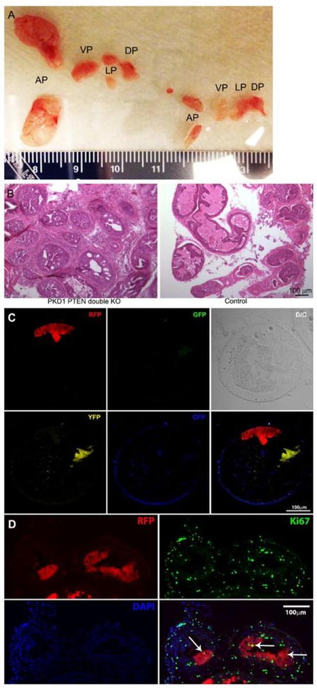 Ki-67 Antibody in Immunohistochemistry (IHC)