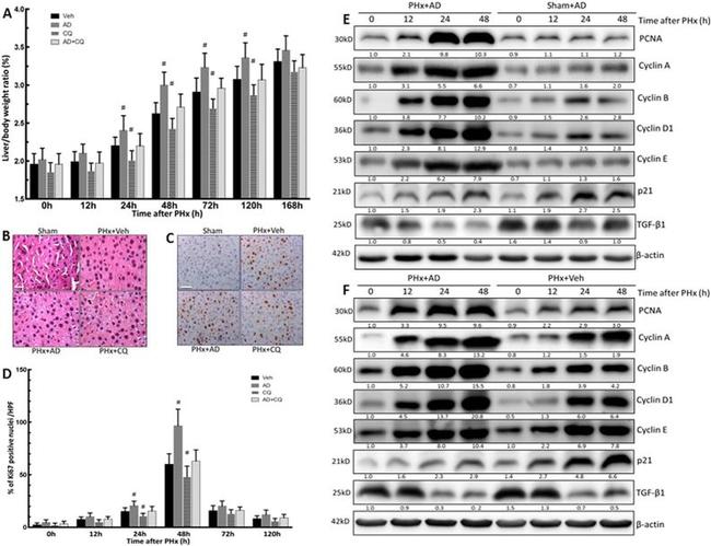 Ki-67 Antibody in Immunohistochemistry (IHC)