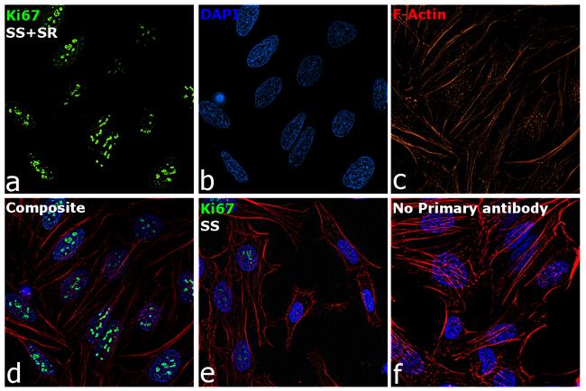 Ki-67 Antibody