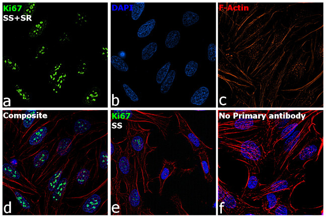 Ki-67 Antibody in Immunocytochemistry (ICC/IF)