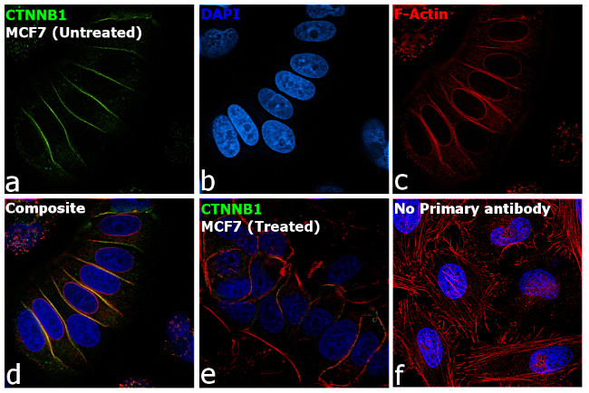 beta Catenin Antibody in Immunocytochemistry (ICC/IF)