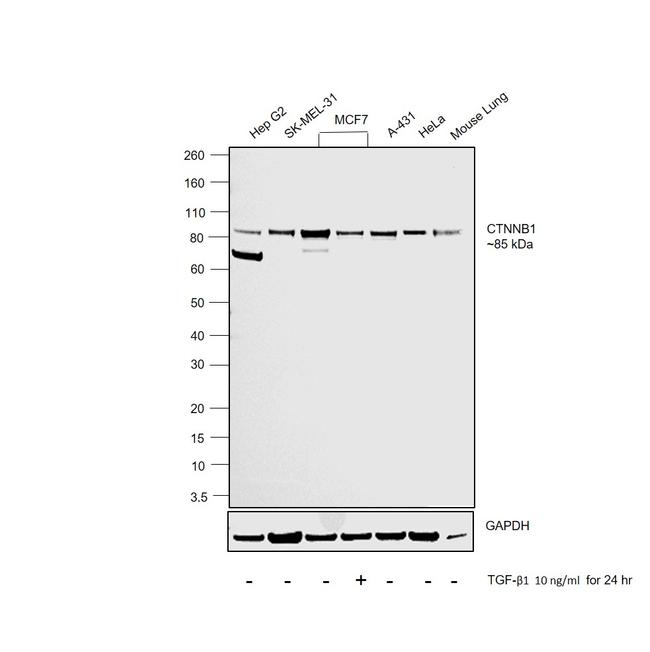 beta Catenin Antibody in Western Blot (WB)