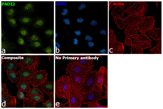 PADI2 Antibody in Immunocytochemistry (ICC/IF)