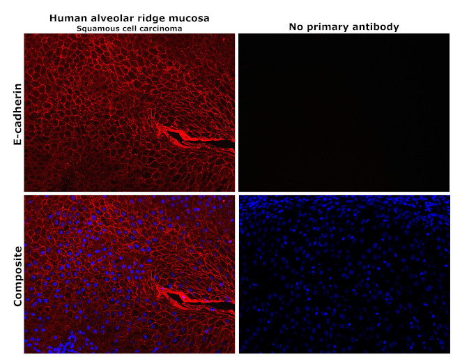 E-cadherin Antibody in Immunohistochemistry (Paraffin) (IHC (P))