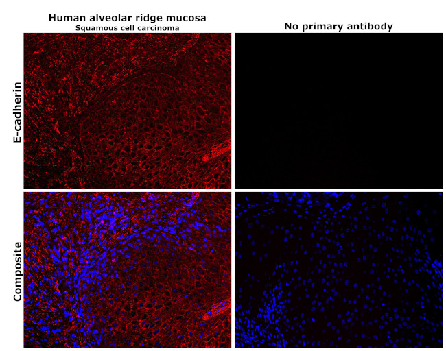 E-cadherin Antibody in Immunohistochemistry (Paraffin) (IHC (P))