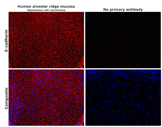 E-cadherin Antibody in Immunohistochemistry (Paraffin) (IHC (P))