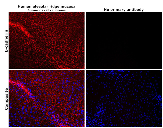 E-cadherin Antibody in Immunohistochemistry (Paraffin) (IHC (P))