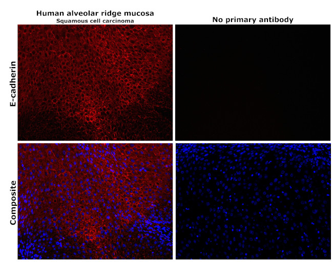 E-cadherin Antibody in Immunohistochemistry (Paraffin) (IHC (P))