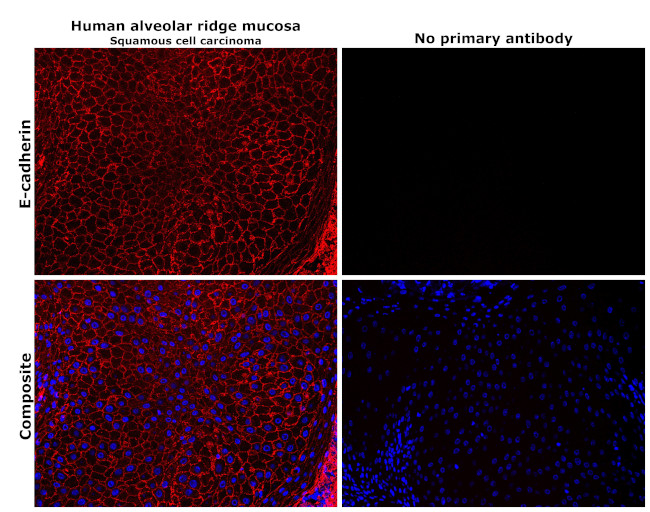 E-cadherin Antibody in Immunohistochemistry (Paraffin) (IHC (P))