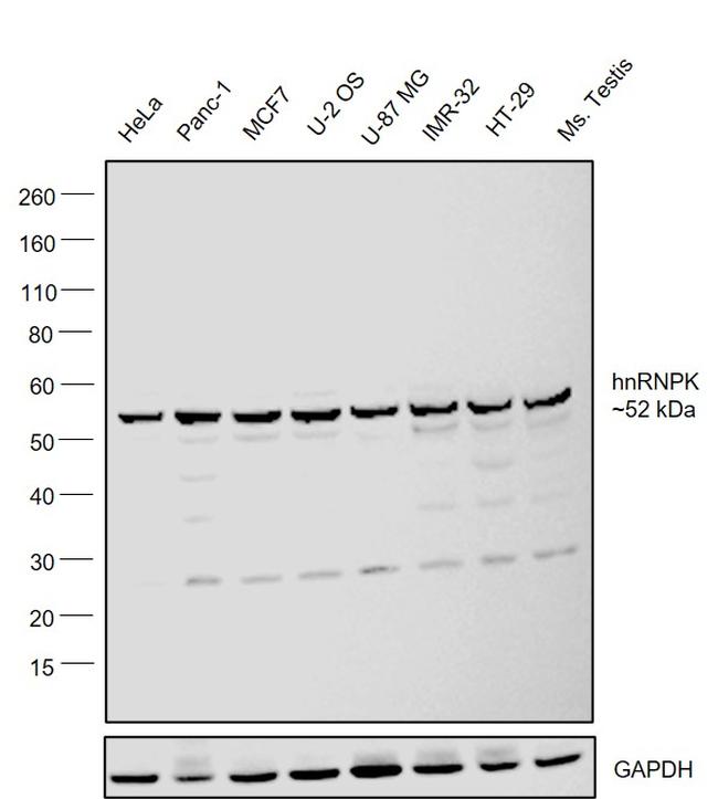 hnRNP K Antibody in Western Blot (WB)