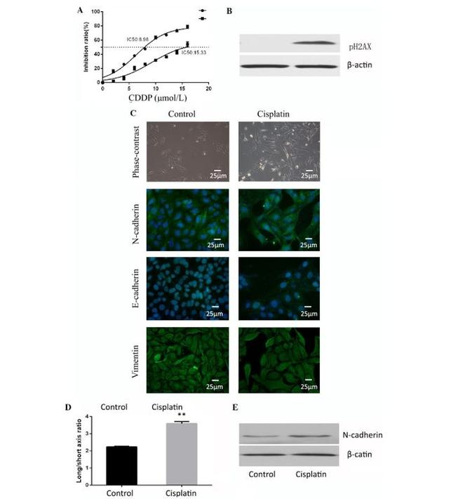 Vimentin Antibody in Immunocytochemistry (ICC/IF)