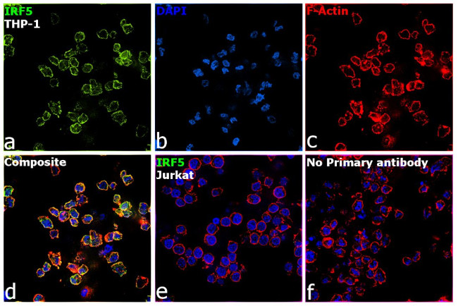 IRF5 Antibody in Immunocytochemistry (ICC/IF)