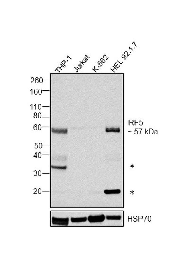 IRF5 Antibody in Western Blot (WB)