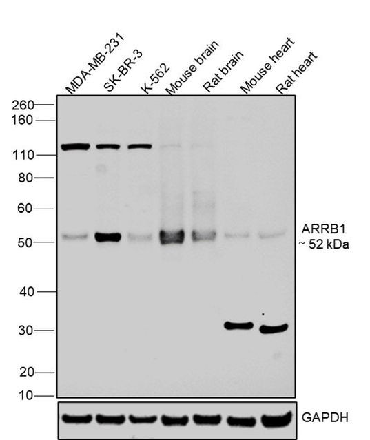 beta Arrestin 1 Antibody