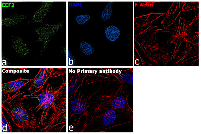 EEF2 Antibody in Immunocytochemistry (ICC/IF)