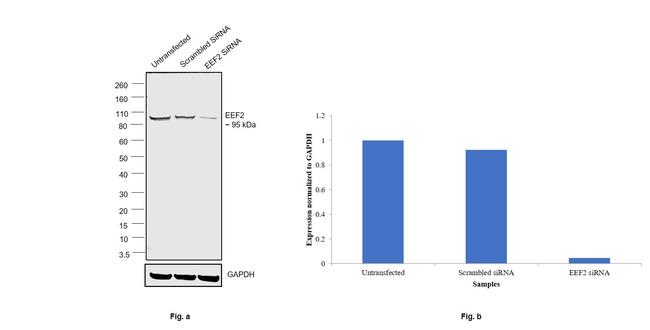 EEF2 Antibody in Western Blot (WB)