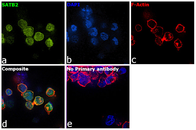 SATB2 Antibody in Immunocytochemistry (ICC/IF)