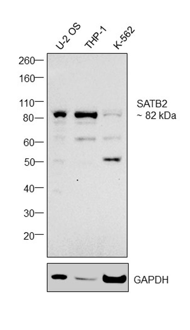 SATB2 Antibody in Western Blot (WB)