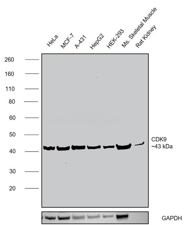 CDK9 Antibody in Western Blot (WB)