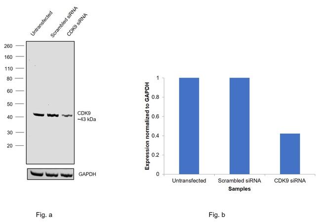 CDK9 Antibody in Western Blot (WB)