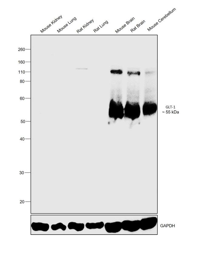 GLT-1 Antibody in Western Blot (WB)