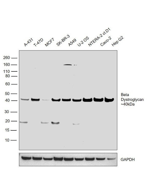 beta Dystroglycan Antibody