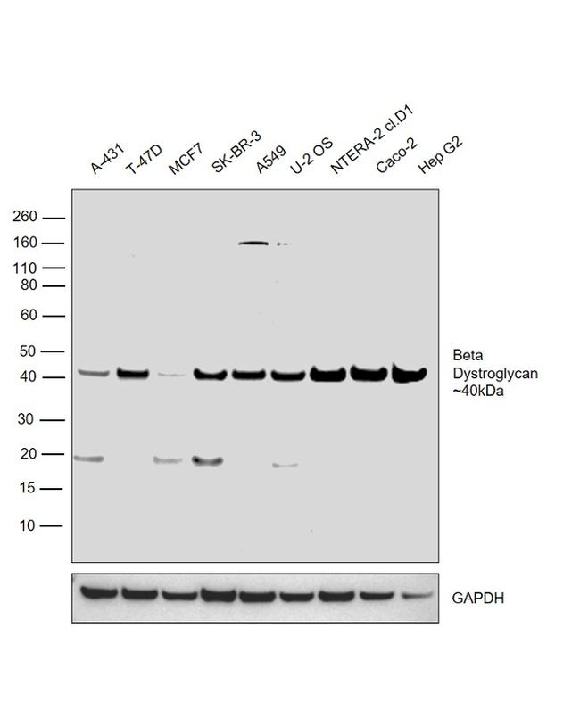 beta Dystroglycan Antibody in Western Blot (WB)