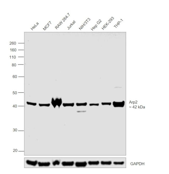 Arp2 Antibody in Western Blot (WB)