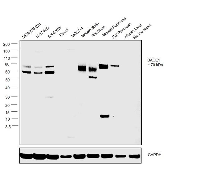 BACE1 Antibody in Western Blot (WB)