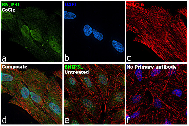 BNIP3L Antibody in Immunocytochemistry (ICC/IF)