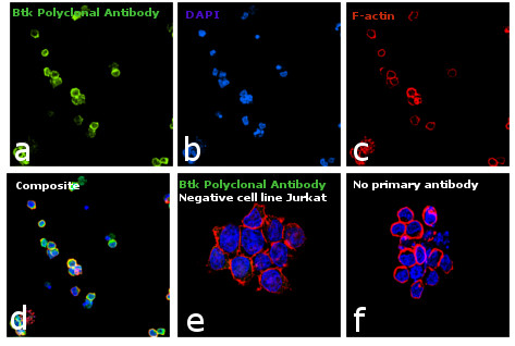 Btk Antibody in Immunocytochemistry (ICC/IF)