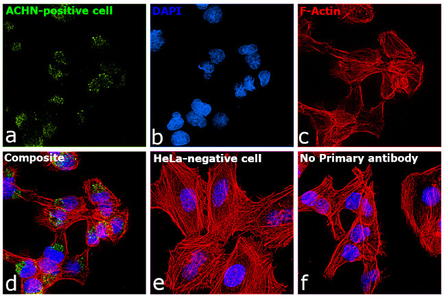 TIM-1 Antibody in Immunocytochemistry (ICC/IF)