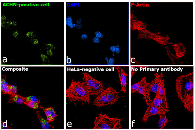 TIM-1 Antibody