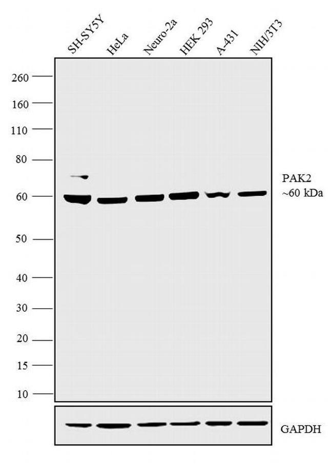 PAK2 Antibody in Western Blot (WB)