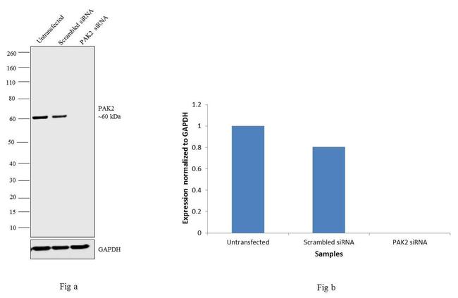 PAK2 Antibody in Western Blot (WB)