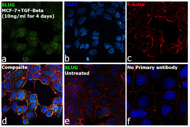 SLUG Antibody in Immunocytochemistry (ICC/IF)