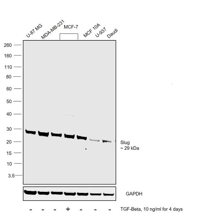 SLUG Antibody in Western Blot (WB)