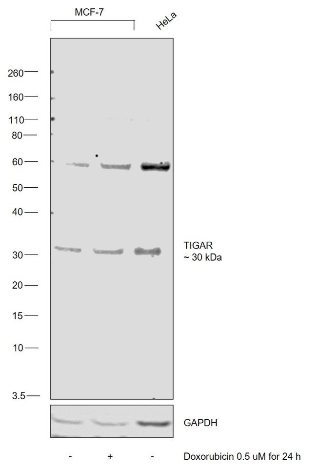 TIGAR Antibody in Western Blot (WB)