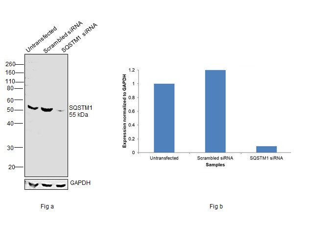 SQSTM1 Antibody