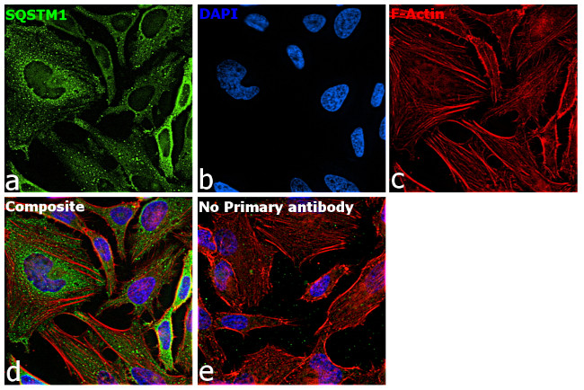 SQSTM1 Antibody in Immunocytochemistry (ICC/IF)