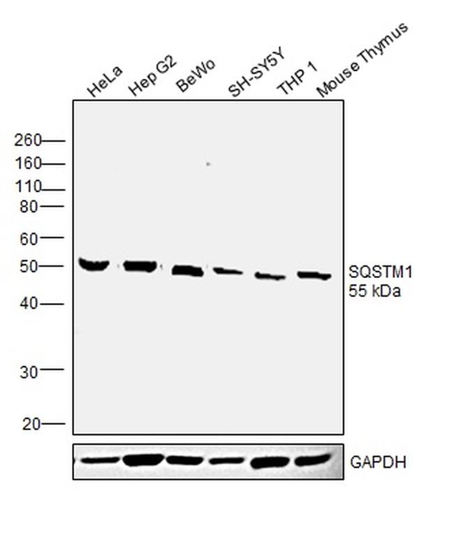 SQSTM1 Antibody in Western Blot (WB)