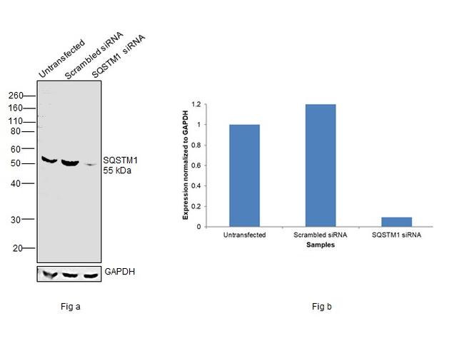 SQSTM1 Antibody in Western Blot (WB)