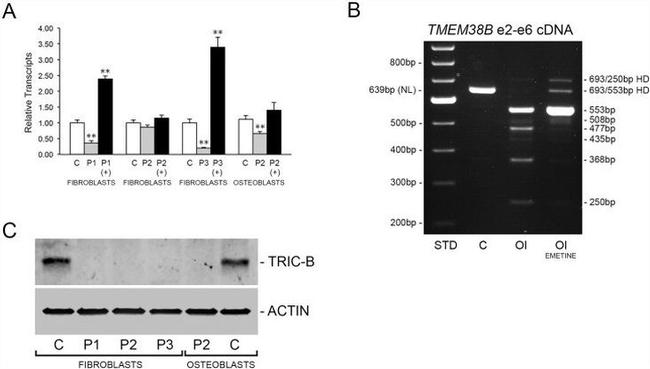 TMEM38B Antibody in Western Blot (WB)