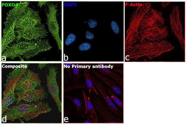 FOXO4 Antibody in Immunocytochemistry (ICC/IF)