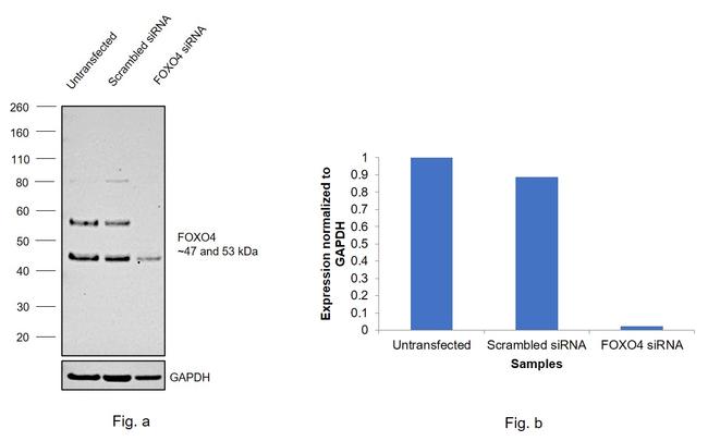 FOXO4 Antibody in Western Blot (WB)
