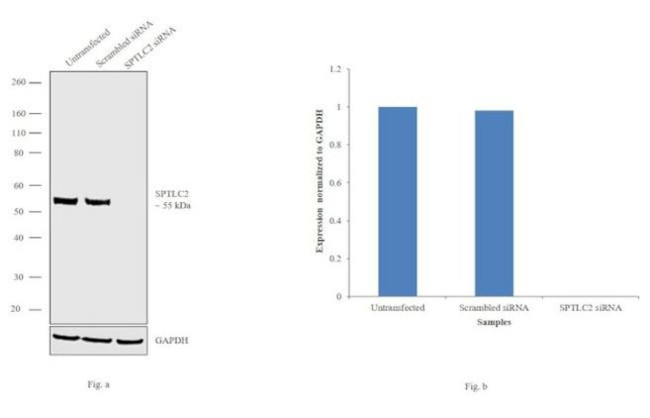 SPTLC2 Antibody