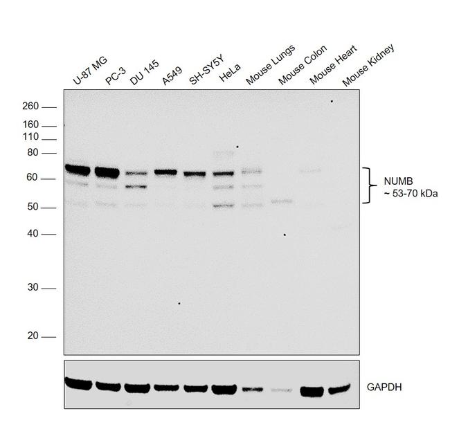 NUMB Antibody in Western Blot (WB)