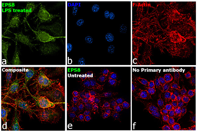 EPS8 Antibody in Immunocytochemistry (ICC/IF)